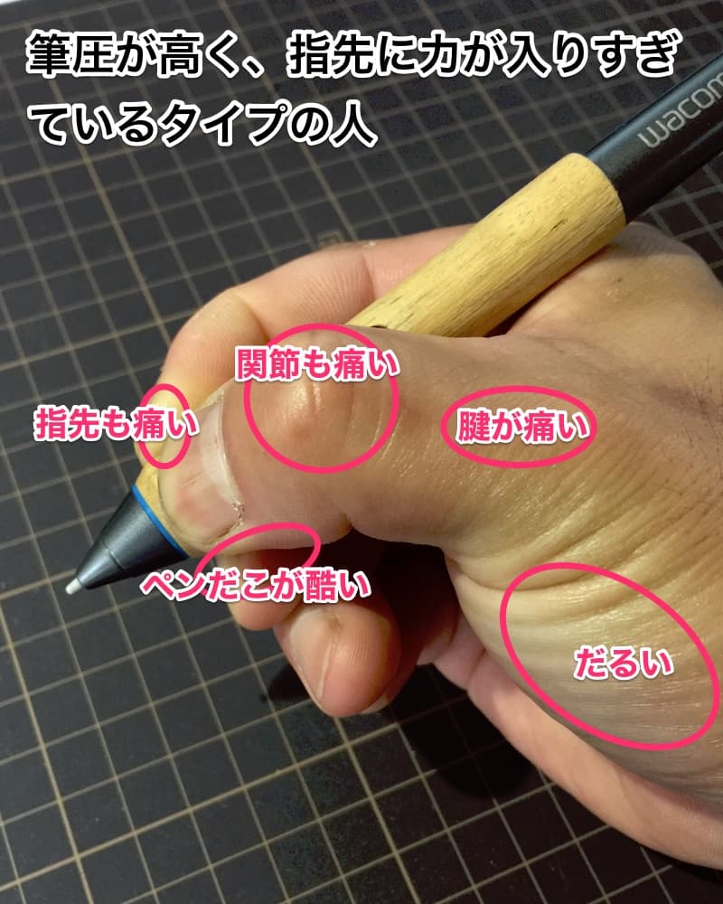 筆圧が高く指先に力が入りすぎているタイプの握り方。痛む部位の図解