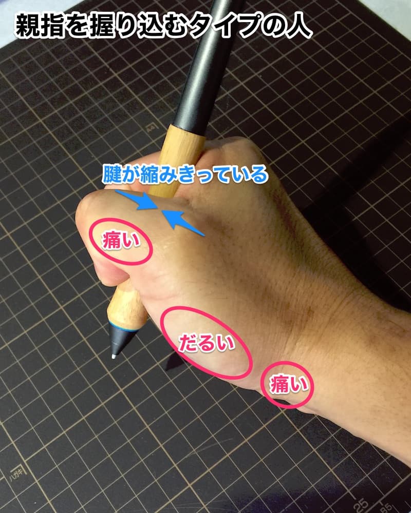 イラストレーターの腱鞘炎対策 親指の痛み編
